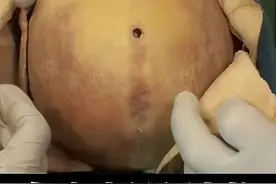 真实人体颅骨内部结构#生命科学 #热门 #大体老师 #标本