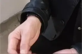 56岁三明大田女患者，反复双手麻木疼痛1年6个月 #手麻 #微创手术 #腕管综合症 #神经外科   #上热门视频封面