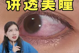 带个美瞳而已，她的眼睛里居然长满了疙瘩…… #健康科普