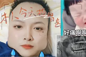 拔完智齿后，感觉舌头根和喉咙痛，有和我一样症状的吗？视频封面