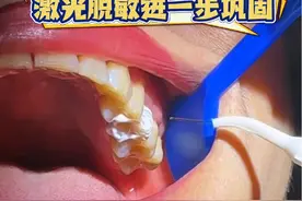 患者牙本质过敏，激光脱敏后效果不错，再做一次巩固一下 #牙本质过敏 #激光口腔诊疗 #看牙 #牙医日常 #口腔医生赵晶 @DOU+小助手 @抖音医疗健康小助手 @健康中国 @健康北京视频封面