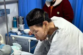 年轻小伙因偶尔嚼食槟榔，换来如今这下场，害了自己苦了家人#长期嚼槟榔的危害有多大 #口腔癌 #经历过的人才能深有体会