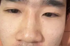 还有一种人是因为某个年龄段受了一种很大打击，然后对生活失去了兴趣开始摆烂的，无论什么原因都不能清醒着，看着自己堕落下去，记住了，兄弟千万别摆，不是为了任何人为了自己的幸福，为了以后能好好照顾父母好吧视频封面