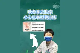 皮肤遇冷就起风团 寒冷性荨麻疹怎么预防和治疗 #硬核健康科普行动 #医疗健康创作训练营 #寒冷性荨麻疹 #风团荨麻疹 #血管性水肿