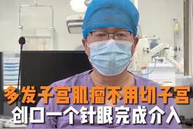 30岁不到，多发子宫肌瘤最大8公分，不开刀完成介入手术 #子宫肌瘤 #关爱女性健康 #医学科普 #抖出健康知识宝藏