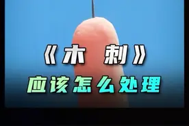 被鱼钩勾住该如何取出，看完你就明白了 #科普 #科普一下 #木刺