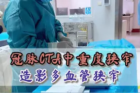 冠脉CTA中重度狭窄，造影后多血管狭窄#造影 #心梗救治日 #硬核健康科普dou来说 #支架视频封面