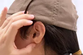 美女做了耳垂裂修复，以后可以戴漂亮的耳饰了。  #耳垂裂 #耳垂裂术后效果图片 #耳再造钱瑾#八大处钱瑾 #医途暖光视频封面