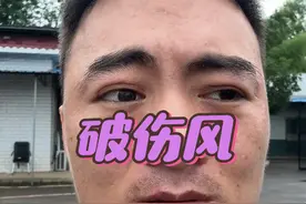破伤风需要打吗？ 你敢听实话吗？#破伤风 #兽医 #说真话