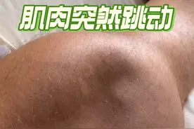 腿上的肌肉不停跳动，其实这就是肌肉痉挛！ #科普 #冷知识 #抽筋 #猛男必备视频封面