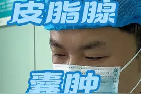 皮脂腺囊肿还是尽量不要去抠和挤#皮脂腺囊肿 #医学科普 #皮脂腺囊肿切除 #科普视频封面