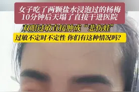 6月12日（采访时间），湖北。女子就吃了两颗杨梅，双眼直接过敏肿成“悲伤蛙”。#万万没想到 #过敏 #杨梅 #过敏体质视频封面