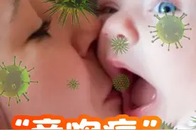 亲吻病”真相：传染性单核细胞增多症的早期症状 传染性单核细胞增多症（Infectious Mononucleosis）。这种疾病特别容易在儿童两岁前感染，由EB病毒（Epstein-Barr virus, EBV）引起。一听到这个病，大家可能会担心，传染性这么强，终身携带，听起来很严重。确实，如果不及时治疗，后果可能很严重。但如果我们能够早期发现并及时治疗，大多数情况下预后都是良好的。 1. 传染性单核细胞增多症的早期症状 传染性单核细胞增多症的症状初看像感冒，但实际上并非如此。以下是它的典型早期症状： 发热：通常是中度到高热，可能持续数天甚至数周。 淋巴结肿大：患者常伴有颈部、腋下或腹股沟等部位的淋巴结肿大。 咽痛：咽喉疼痛，有时伴随扁桃体肿大和白色渗出物。 疲劳：极度疲倦感，持续时间较长。 皮疹：部分患者可能出现皮疹，特别是在使用某些抗生素（如阿莫西林）后。 肝脾肿大：少数患者可能出现肝脾肿大的情况。 2. 为什么叫“亲吻病”？ 传染性单核细胞增多症还有一个俗称，叫“亲吻病”。为什么呢？因为很多大人嘴上的疱疹，我们常以为是上火，实际上可能是病毒感染。这些疱疹的液体或分泌物可能会传给孩子，孩子在抵抗力低的时候可能会被感染，从而患上传染性单核细胞增多症。因此，如果家长或成人嘴上有疱疹，最好不要亲吻孩子，哪怕是亲脸，也要小心，因为这也可能让孩子感染病毒。 3. 何时就医？ 如果孩子出现以下症状，千万不要拖延，要赶紧去医院： 持续的高烧 淋巴结肿大 极度疲倦 咽喉疼痛 皮疹 4. 预防措施 当然，预防措施也很重要，以下几点可以帮助减少感染风险： 戴口罩：特别是在流感季节或人多的地方。 勤洗手：保持手部卫生，避免接触口鼻。 保持通风：定期开窗通风，保持空气新鲜。 消毒：对常用物品和表面进行定期消毒。 少去人多的地方：尤其是在流感季节，尽量减少前往人群密集的地方。 总结 传染性单核细胞增多症虽然传染性强，但如果能够早期发现并及时治疗，大多数情况下预后都是良好的。了解疾病的早期症状，采取适当的预防措施，可以有效保护自己和家人，特别是婴幼儿。希望这些信息能帮助大家更好地应对这一疾病，保持健康，平安无事。#抖出健康知识宝藏 #亲吻病 #亲吻病eb病毒 #医姐鸥姐视频封面