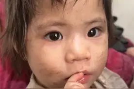 62岁老汉生下五个孩子，最小的女孩肚子为什么这么大？#重发视频封面