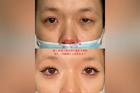 挑战全网化妆必备看到都害怕的一单一双，大小眼还是肌无力的眼睛调整，视频虽长，但很详细哦，#挑战全网画最难的眼睛调整#挑战全网化妆师都不敢画的眼睛#肌无力眼睛调整#大小眼眼睛调整#一单一双眼睛调整 @DOU+上热门 @DOU+小助手