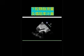 下腔静脉测量及塌陷率计算。#医学科普 #超声影像 #超声学习 #医学小知识 #超声医学 @抖音短视频视频封面