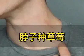 你的脖子被种过草莓吗？#科普一下 #人体奥秘 #涨知识 #吻痕