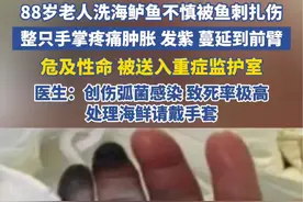 88岁老人洗海鲈鱼时被鱼刺扎伤险些丧命 医生提醒：处理海鲜请戴手套视频封面