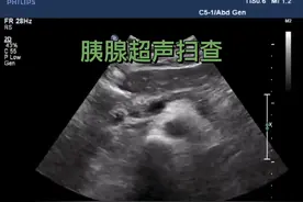 胰腺超声检查（结合脾门处扫查效果更佳）。#医学科普 #超声影像 #超声学习 #医学小知识 #每天学习一点点 @抖音短视频视频封面
