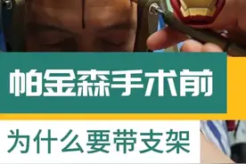 帕金森脑起搏器手术上支架疼不疼 #帕金森手术 DBS脑起搏器手术固定头架的作用 #梅杰综合征 #特发性震颤 #肌张力障碍 #手术室日常
