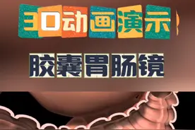 胶囊胃肠镜#科普 #医学科普 #医生 #健康 #养生