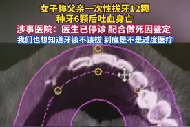 #哈尔滨老人一次拔牙12颗种6颗后身亡，女子称老人离开医院仅几十分钟便突发不适、吐血，最终身亡。（来源：新京报我们视频）