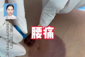 刃针治疗弯腰负重导致的腰痛 #腰痛 #中医 #刃针 #抖出健康知识宝藏 #毛慧芳医生