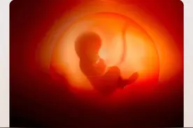 羊水为什么叫“羊水”，为什么不叫“猪水”“鸡水”“鸭水”呢？你有没有想过这个问题呢？#羊水 #科普一下 #怀孕 #看见少数 #一个都不能少