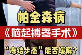 一起来看帕金森冻结步态脑起搏器手术后能否缓解？ #在抖音pick你的健康搭子 #抖出健康知识宝藏 #解锁春日健康清单 #医疗健康创作训练营#帕金森脑起搏器手术视频封面