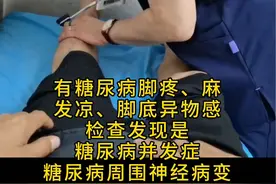 糖尿病周围神经病变脚麻、疼、发凉，脚底异物感#糖尿病周围神经病变 #糖尿病并发症 #糖尿病视频封面
