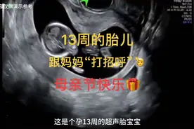 #创作灵感 13周胎儿在跟妈妈“打招呼”祝妈妈母亲节快乐🎁🎉视频封面