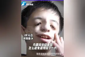 鸟面综合征基因怎么避免遗传给下一代#遗传基因 #医学科普 #接一切好孕 #辅助生育