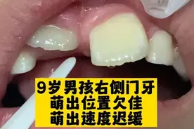 内心播种美好，生活就会馈赠美好#孩子门牙长歪 长得慢是咋回事视频封面