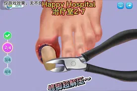 修脚啦！！#解压小游戏 #这个游戏很好玩 #模拟手术 #超级解压