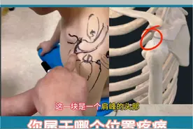 肩部疼痛位置图 肩部疼痛位置图，常见的疼痛都在这里！你属于哪个位置疼？#医疗创作者培优计划 #肩部疼痛位置图详解 #三伏天养生 #硬核健康科普行动 #肩袖损伤