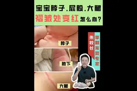 宝宝脖子、腋下、大腿褶皱变红怎么办？ #人类幼崽成长计划 #妈卡爸卡养娃宝典 #内容启发搜索视频封面