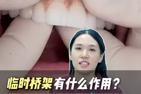 全口种植牙制作会比单颗麻烦，在稳定性足够的情况下也可以当天种牙当天戴牙喔 #种植牙 #硬核健康科普行动 #医途暖光  #舒林径#全口种植牙视频封面