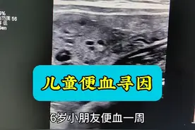 6岁儿童便血寻因。#超声影像 #医学科普 #超声学习视频封面