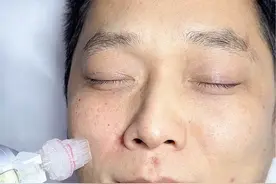 水光针有什么作用呢？为什么那么多人都喜欢呢？它主要就是补水保湿、美白淡斑、缩小毛孔、控油、改善细纹、干纹，上妆自然、不卡粉。所以，现在连男的都开始打了，真的这么卷吗？#水光针 #水光针原理 #皮肤科 #三甲医院皮肤科视频封面