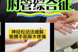 #肘管综合征 #小指麻木 #手麻木 #缓解 #硬核健康科普dou来说视频封面