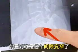 腰肌酸痛会是腰椎出现问题吗#硬核健康科普行动 #腰椎 #腰酸 #椎间盘 #脊柱健康视频封面