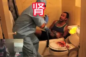 如果一觉醒来发现自己的腰子没了。你会怎么办呢。 #这谁顶的住啊