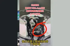 输尿管结石小于0.6cm时可以采取多种不同的处理方式，但是一定注意要复查。当结石长期没有移动时务必尽早处理，避免严重后果！#输尿管结石 #肾积水 #输尿管狭窄 #微创手术 #泌尿外科郑鑫医生