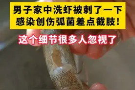 不小心被鱼虾扎手了，千万别忽视！#医学科普 #科普 #鱼虾 #海洋创伤弧菌 #涨知识