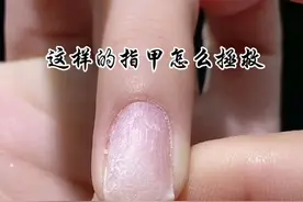 指甲受损严重，剪掉也容易开裂，不如这样养甲#纤维胶#美甲纤维#美甲断甲 #美甲vlog #美甲教程