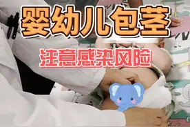 看看你们家宝宝有没有包茎？#生长发育 #发育 #环切术 #复旦儿科儿保彭咏梅 #上海星晨儿童医院