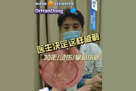 30年双手掌心疤痕，医生决定这样破解。#手被烫伤留下的疤痕能去掉吗 #抖出健康知识宝藏 #在抖音pick你的健康搭子 #解锁春日健康清单 #上海九院韩冬