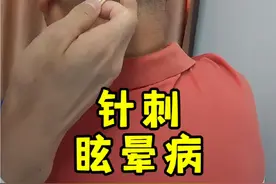 针刺，眩晕病。 #分享日常扎针 #医学科普 #中医 #穴位 #硬核健康科普行动