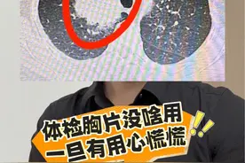 胸片发现问题，往往就是大问题。#肺结节 #肺癌 #胸片 #医学科普 #胸外科视频封面