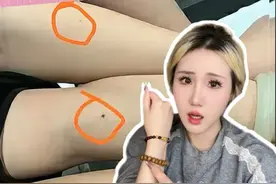 你的左臂有痣吗？我们真的是npc？ #npc #人机 #宇宙视频封面